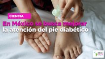 En México se busca mejorar la atención del pie diabético