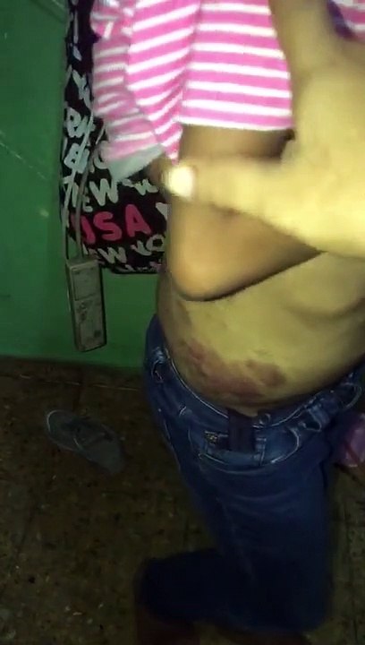 Madre pide ayuda para costear estudios y tratamiento médico de su hija menor de edad