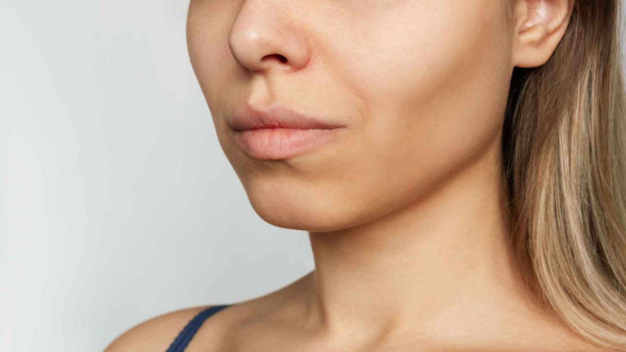 Buccal Fat Removal: Deshalb ist der Beauty-Trend so toxisch