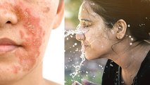 सर्दियों में कितनी बार चेहरा धोना चाहिए,सर्दियों में बार बार चेहरा धोने से क्या होता है | *Health