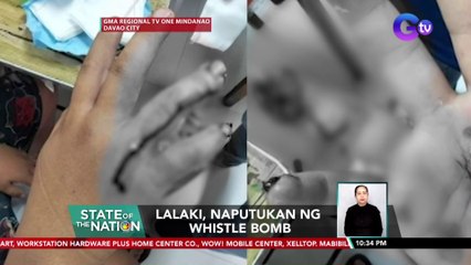 Lalaki, naputukan ng whistle bomb | SONA