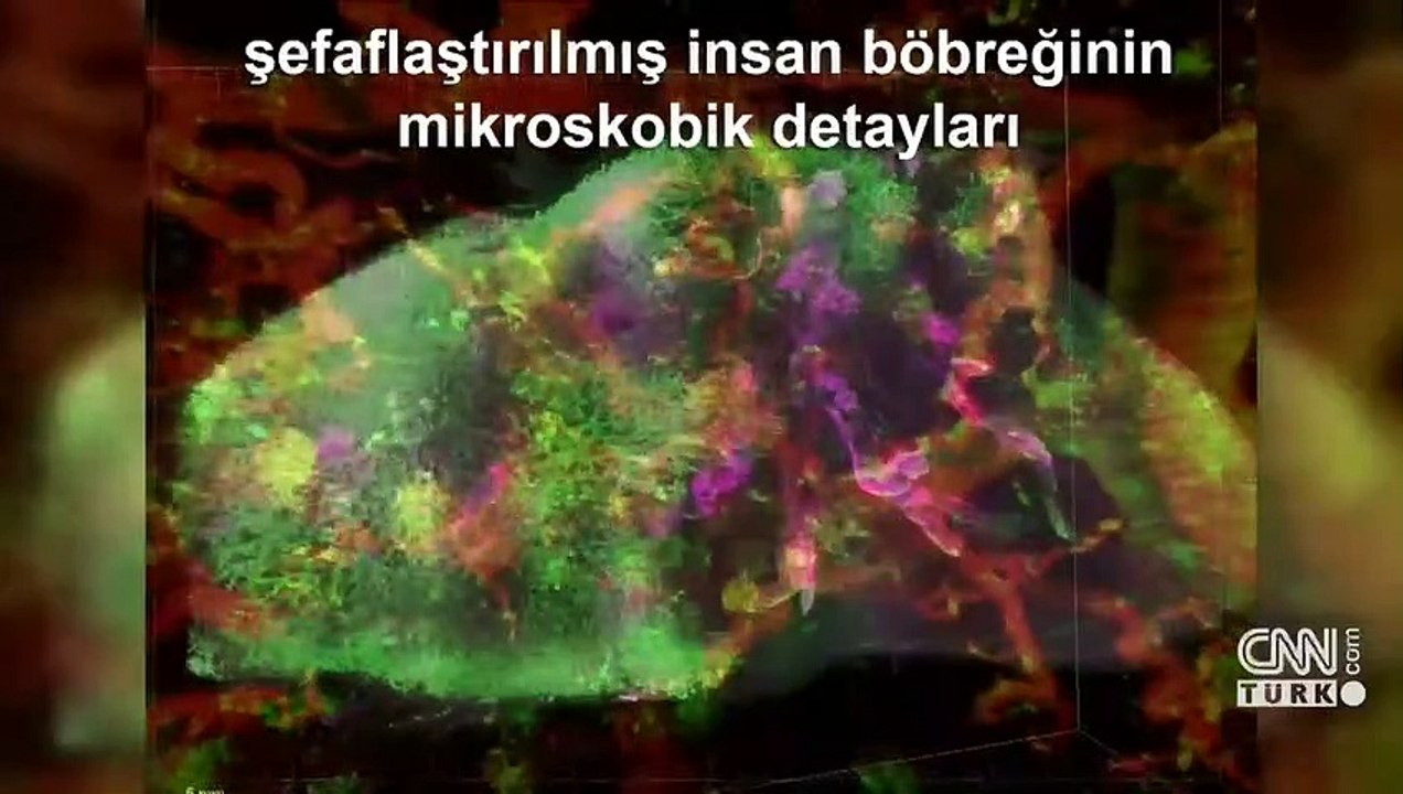 Dünyada bir ilke imza atan bilim insanı CNN TÜRK'te