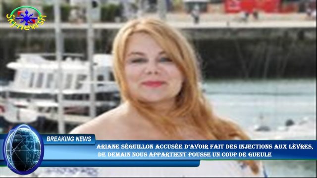 Ariane Séguillon accusée d’avoir fait des injections aux lèvres, de Demain nous appartient pousse u