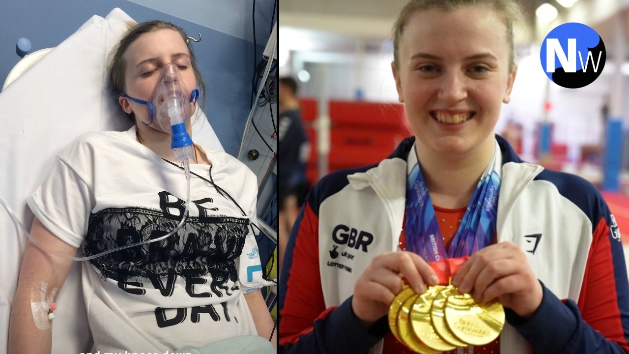 Natasha Coates: "I'm allergic to pretty much everything" | Mast Cell Activation Syndrome explained