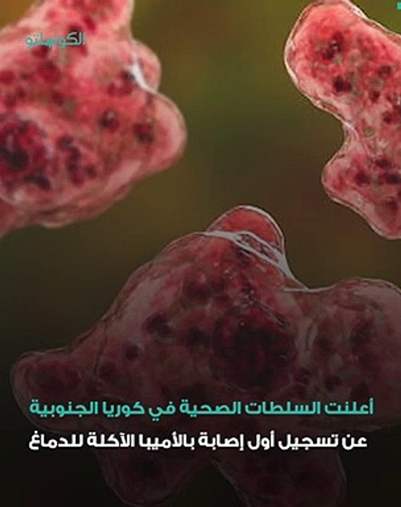 بعد تسجيل إصابة في كوريا الجنوبية- ما هي الأميبا الآكلة للدماغ؟