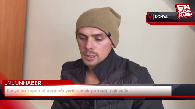 Konya'da kopan el parmağı yerine ayak parmağı nakledildi