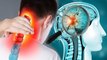 Cervicogen Headache क्या होता है, सर्वाइकोजेनिक सिरदर्द के क्या कारण है |Boldsky*Health