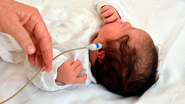 bd-tamizaje auditivo-en-el-recien-nacido-291222