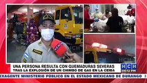 Explosión de chimbo de gas deja una persona con graves quemaduras en La Ceiba