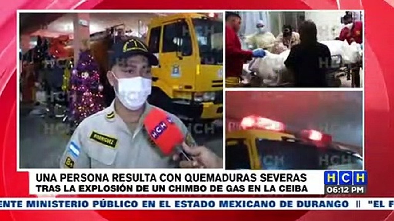 Mujer resulta con severas quemaduras tras explosión de "chimbo" en La Ceiba