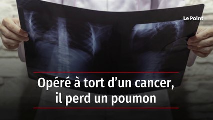 Opéré à tort d’un cancer, il perd un poumon