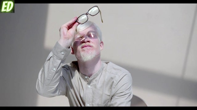 Is Premature Hair Greying Giving You Nightmares?