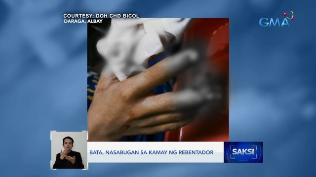 DOH: Mas mataas ang mga naitalang naputukan ngayong taon kumpara noong salubong 2022 | Saksi
