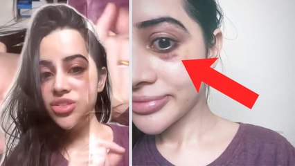 Urfi Javed Without Makeup Look में दिखाएं Eyes के नीचे चोट के निशान, Video Viral । *Entertainment