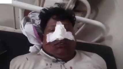 गुना : दुकानदार पर ईंट पत्थरों से हमला, खून से लथपथ पहुंचा अस्पताल