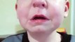Un enfant en panique parce qu'il a un LEGO coincé dans le nez