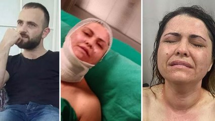 Bayrampaşa'da eski eşe kimyasal maddeli saldırı anı kamerada!