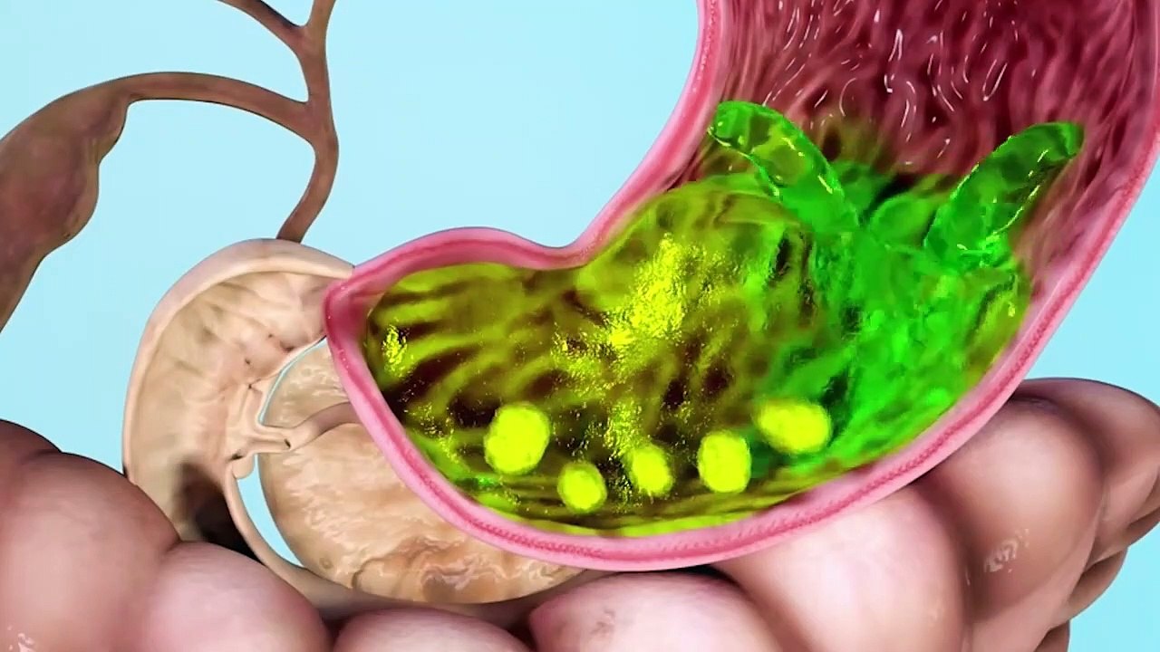 आपका खाना पच रहा है या सड़ रहा है    how to improve digestion naturally at home   Ikigai MD SHAHWAN