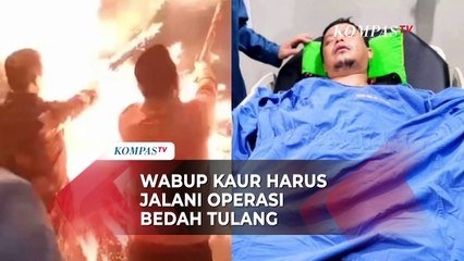 Wabup Kaur Jalani Operasi Pasca Kembang Api Meledak di Genggaman Tangan saat Perayaan Tahun Baru