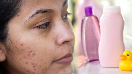 चेहरे पर Baby Oil लगाने से क्या होता है । चेहरे पर Baby Oil लगाने के नुकसान । Boldsky *Health