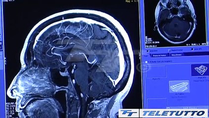 Video News - NUOVA DIAGNOSTICA A DESENZANO