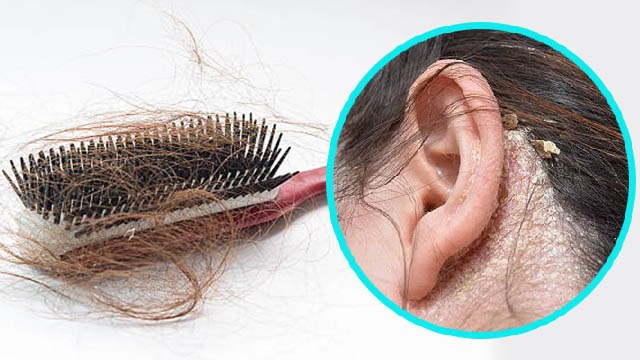 Hair Brush को साफ न करने से क्या होता है । Hair Brush को साफ करने के फायदे । Boldsky *Health