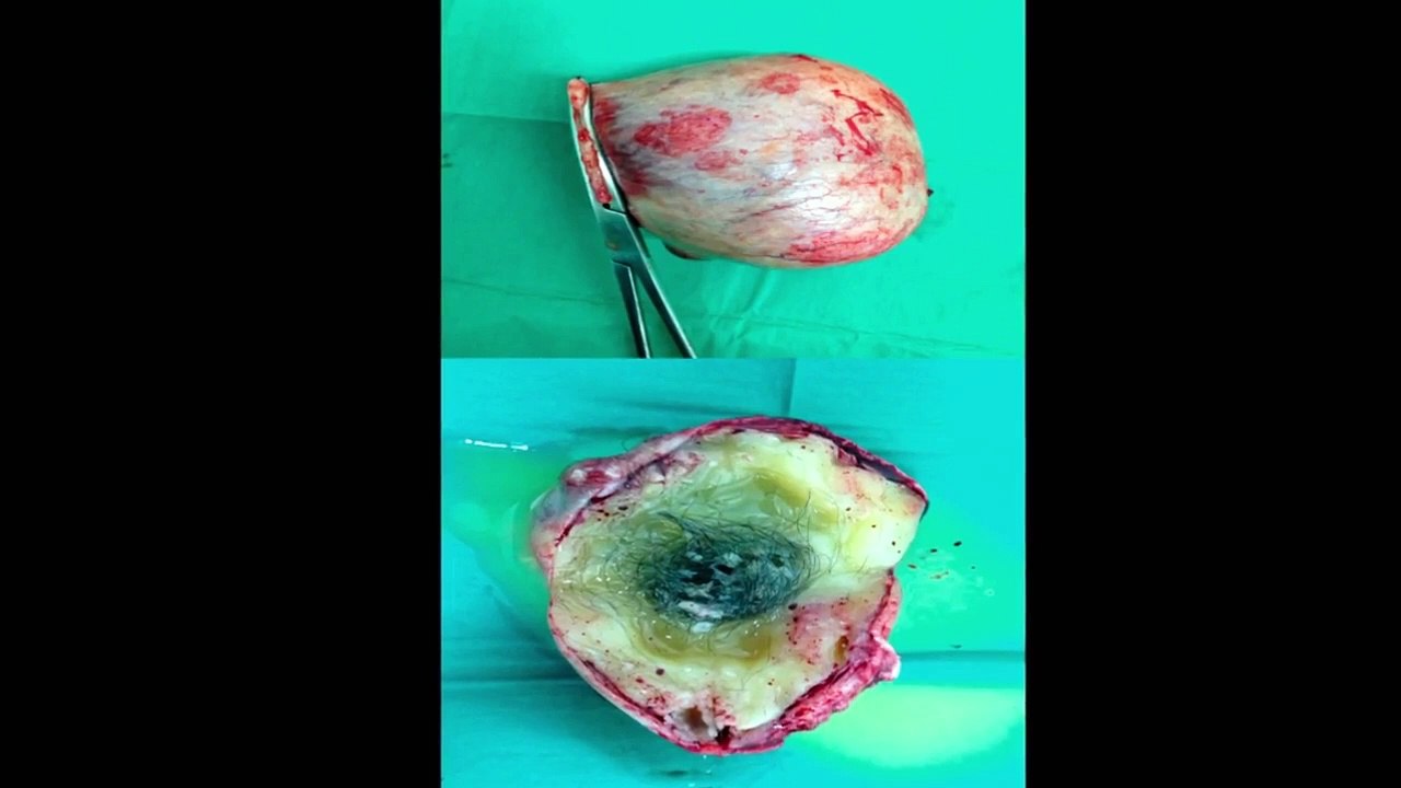 Dr. Pimple Popper - Se6 - Ep08 HD Watch