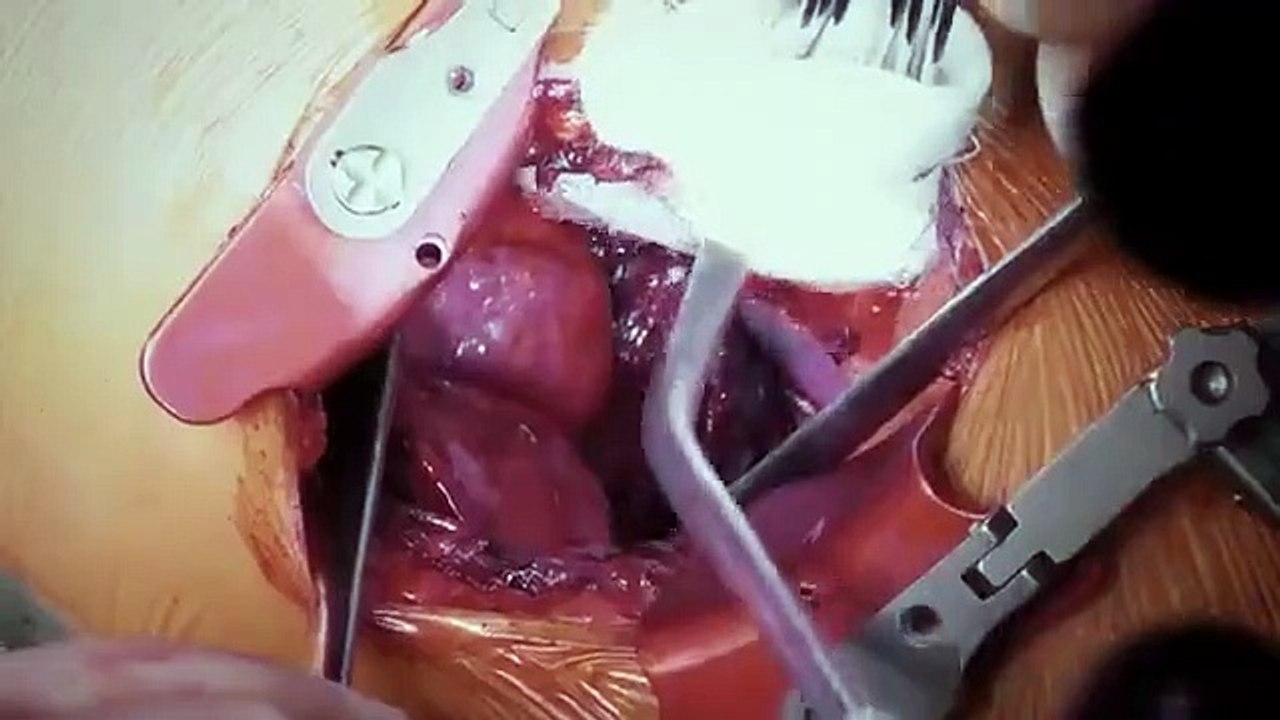 Surgeons - At the Edge of Life - Se3 - Ep03 HD Watch