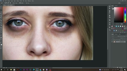 Remove Dark Circles Naturally 1 -Minute Photoshop