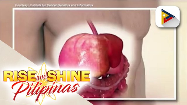 SAY NI DOK | Liver Cancer and Viral Hepatitis Awareness and Prevention Month: Alamin kung paano maiiwasan ang liver cancer ngayong 2023