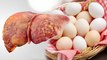 फैटी लिवर में अंडा खाना चाहिए या नहीं | Eating Eggs In Fatty Liver Safe or Not | Boldsky *Health