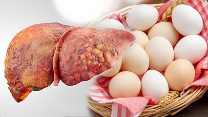 Tải video: फैटी लिवर में अंडा खाना चाहिए या नहीं | Eating Eggs In Fatty Liver Safe or Not | Boldsky *Health