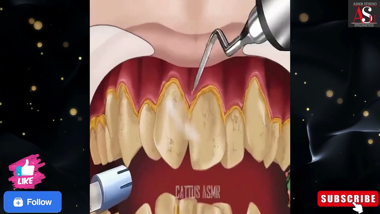 ASMR Dental Cleaning & Restoration|dental cleaning|asmr dental cleaning roleplay@asmrstudiounlimited