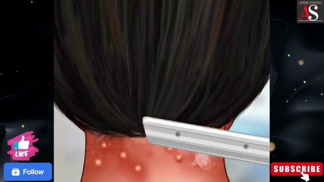 ASMR Dandruff Removal|relaxing asmr|dandruff treatment|dandruff removal|Lice|@asmrstudiounlimited
