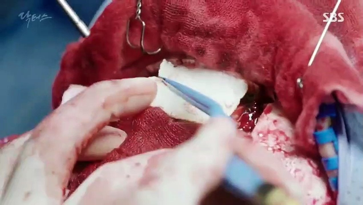 Doctors - Ep11 HD Watch