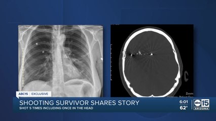Valley woman shares story after being shot 5 times