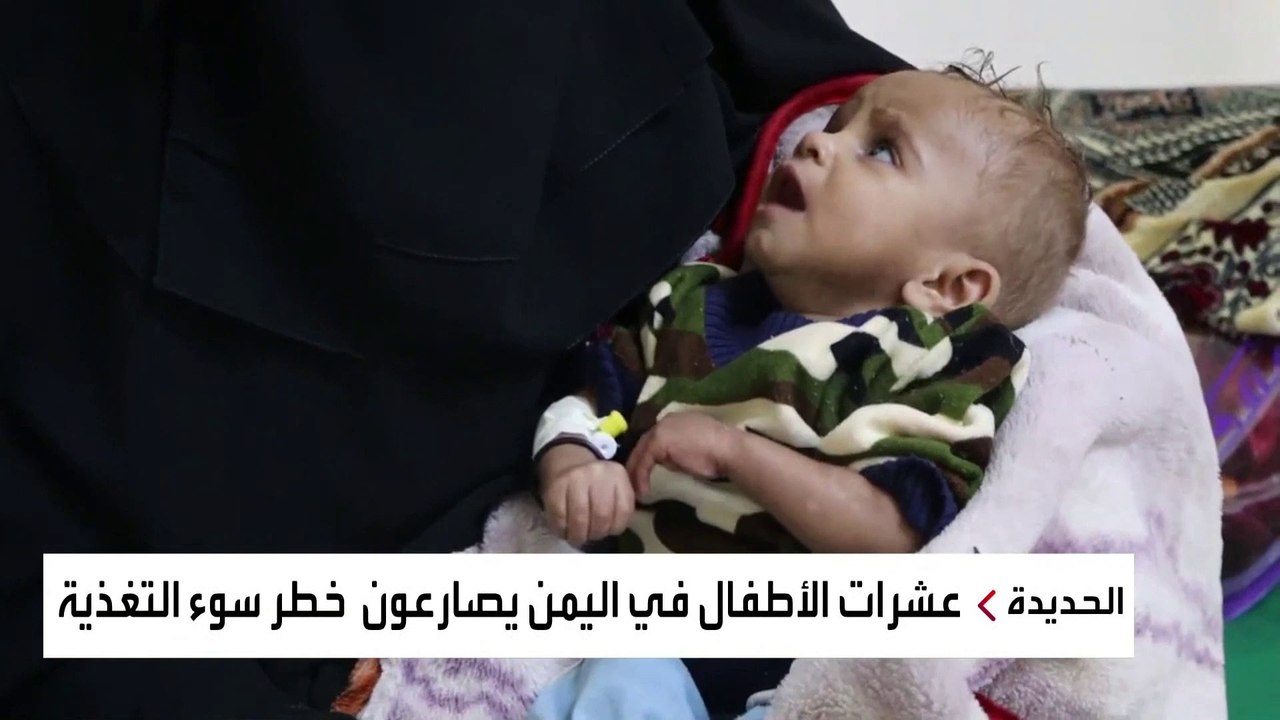 مستشفى بالحديدة يستقبل مئات اليمنيين من المصابي...