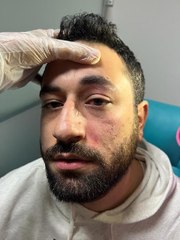 ŞİZOFRENİ RAPORU BULUNAN HASTA, DOKTORA YUMRUK ATTIĞI İDDİASIYLA GÖZALTINA ALINDI