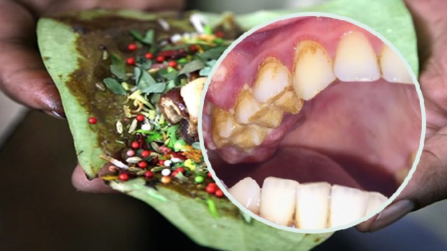 ज्यादा पान खाने से क्या होता है | ज्यादा पान खाने नुकसान | Paan Khane Ke Nuksan | Boldsky