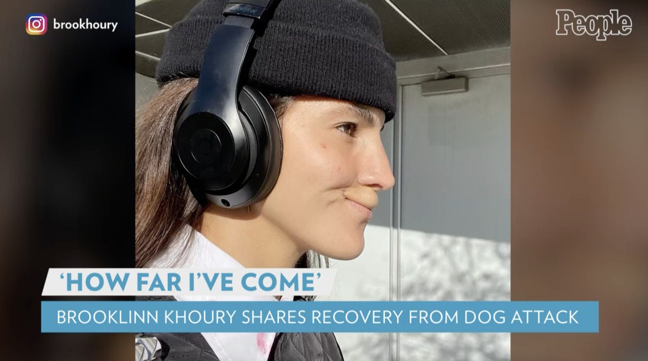 Skateboarder and Model Brooklinn Khoury Reflects on 'How Far I've Come' Since Being Mauled by a Dog
