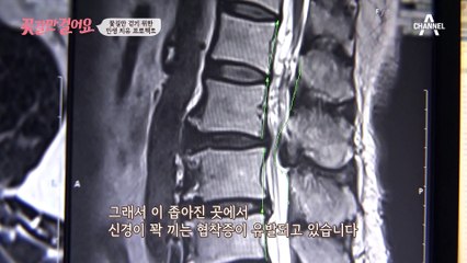 극심한 통증으로 힘들었던 그녀의 몸 상태는?