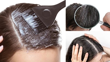 बालों में दही लगाना चाहिए या नहीं । बालों में दही लगाने के फायदे । Boldsky *Health