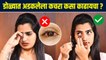 डोळ्यात काहीतरी गेलंय ? | How to remove something stuck in your eyes |  Eye Safety | Lokmat Sakhi