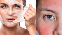 Face पर Peel Off Mask लगाने के नुकसान | Face Par Peel Off Mask Lagane Ke Nuksan | Boldsky