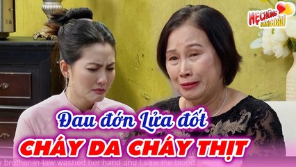 Cụ Bà Đau Đớn Bị Lửa Đốt Cháy Da, Ôm Con Bỏ Trốn Nhớ Về Cảnh Làm Dâu Như Địa Ngục