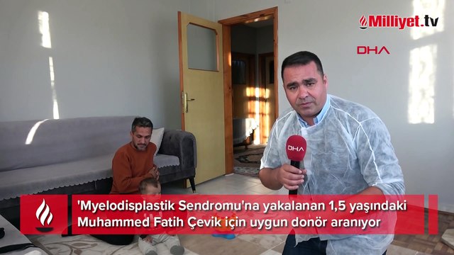 1,5 yaşındaki Muhammmet Fatih ilik nakli bekliyor
