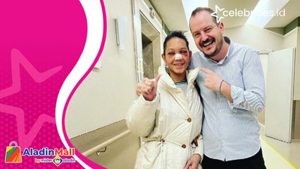 Bunda Corla Makin Cantik usai Operasi Plastik, Siap Menghibur Penggemar di Indonesia