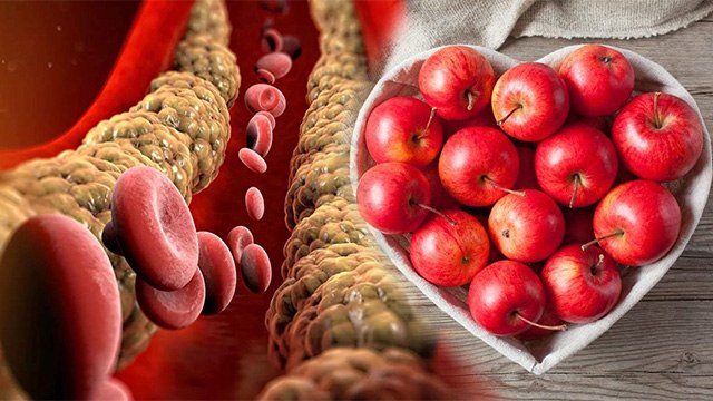 High Cholesterol में इस एक Fruit को खाने से मिलेगी राहत, जानें इसे खाने के फायदे | Boldsky *Health