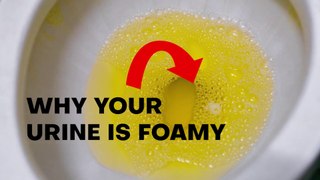 is it NORMAL to have a FOAMY URINE: Cause and Treatme