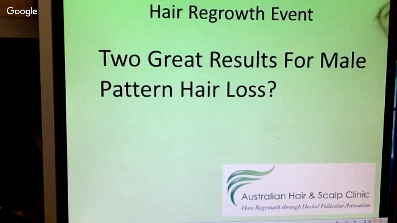Two Results For Male Pattern Hair Loss Video Dailymotion